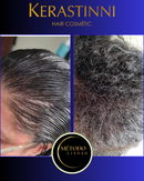 4 Ativos Método Liso3D